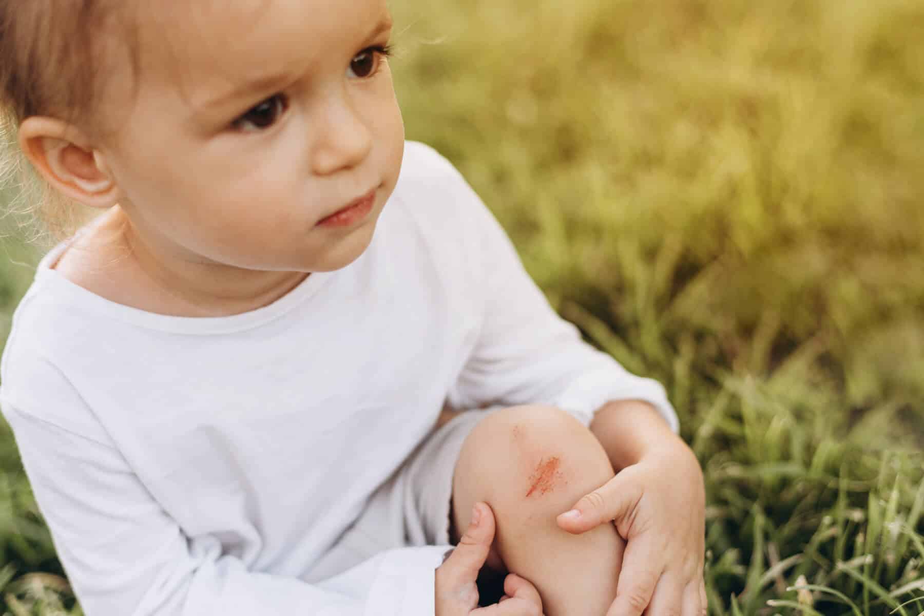 Homeopathic Remedies for Cuts Grazes and Wounds Homeopathic Remedies for Cuts Grazes and Wounds